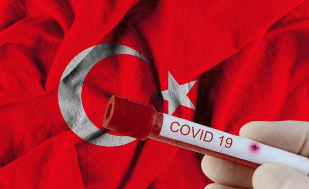 COVID-19 infection blood test in laboratory chinese infection Novel Corona virus of Turkey